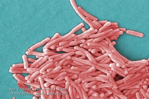 Realizzare Impianti Idrici Scongiurare Rischi Legionella